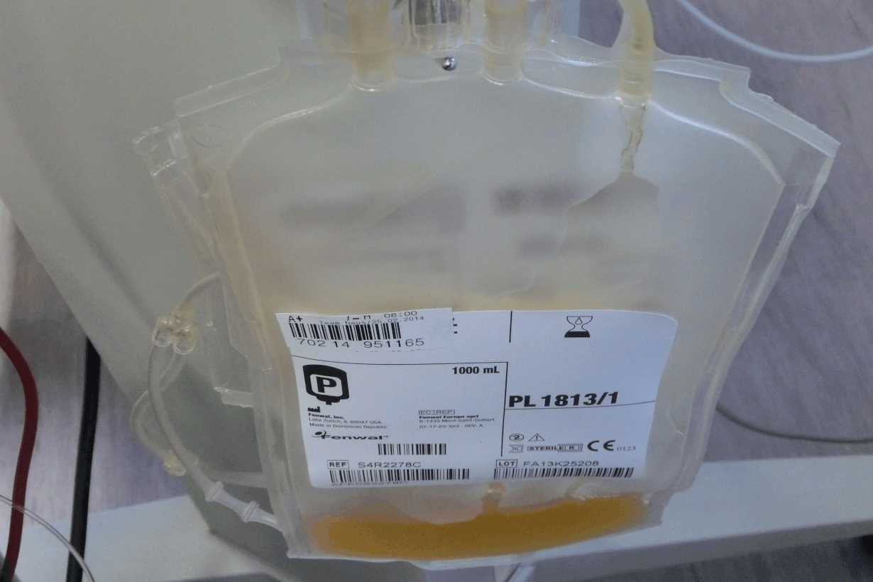Plasma erotellaan kokoverestä koneellisesti. Kuva: Ankawu/Wikimedia Commons