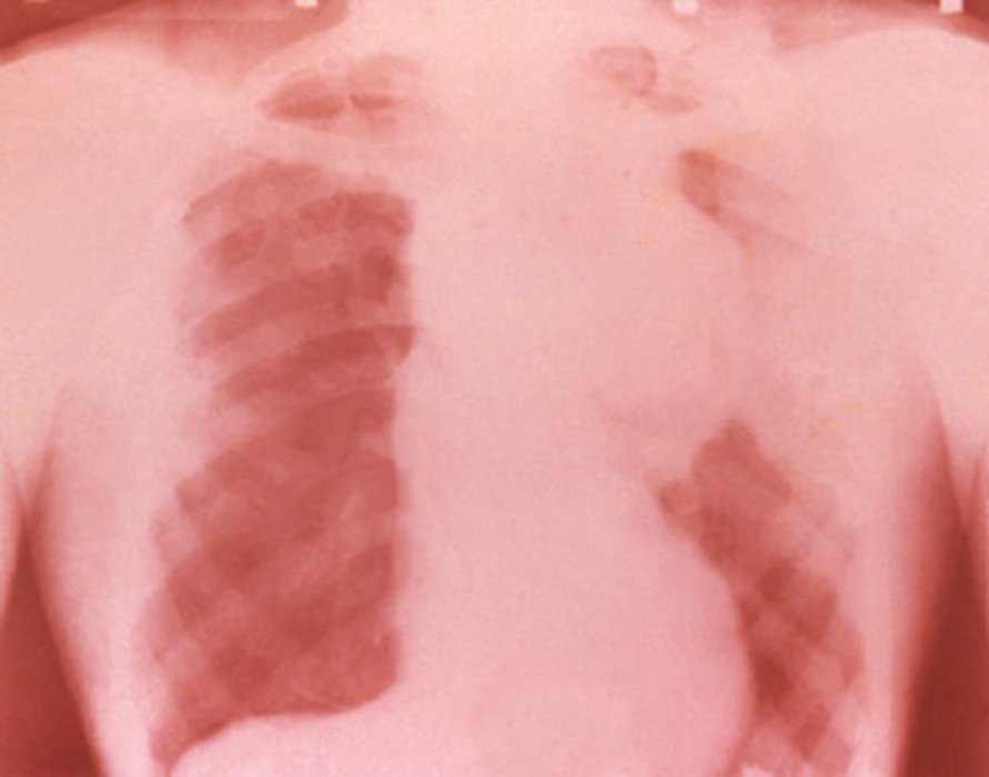 Kuva: <span class="photographer">NIH.</span>