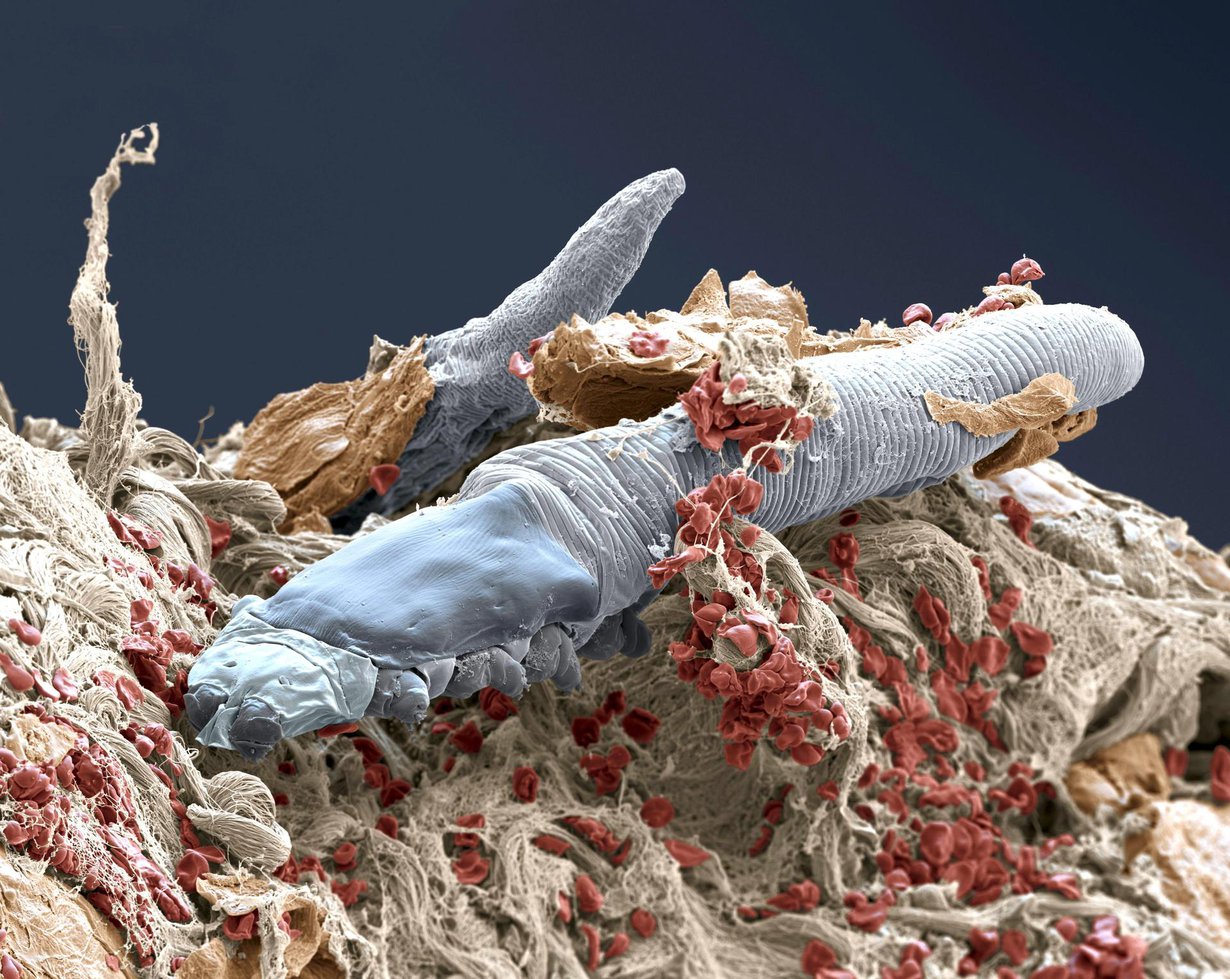 Talipunkki Demodex folliculorum on niin pieni, ettei sitä paljaalla silmällä erota.