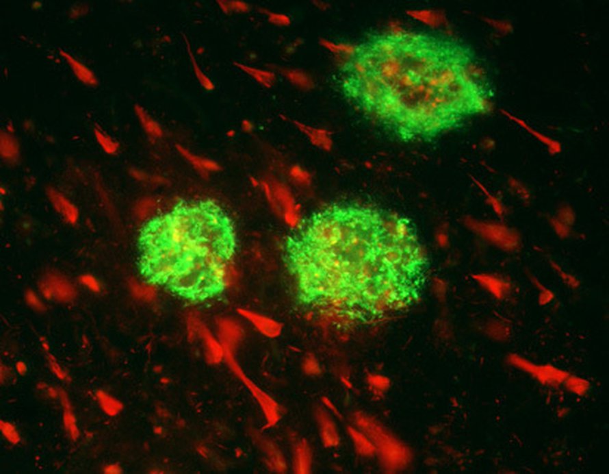 Alzheimeria aiheuttavaa plakkia (vihreä) ja proteiinikimppuja (punainen). Kuva: <span class="photographer">Nga Bien-Ly and Jorge Palop.</span>
