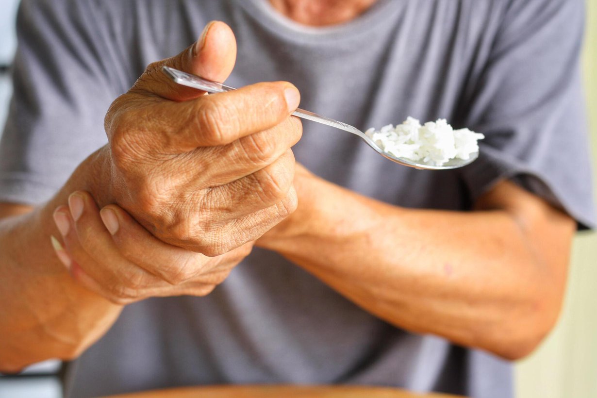 Parkinsonin taudin aiheuttama vapina voi vaatia tukea toiselta kädeltä. Kuva: Shutterstock