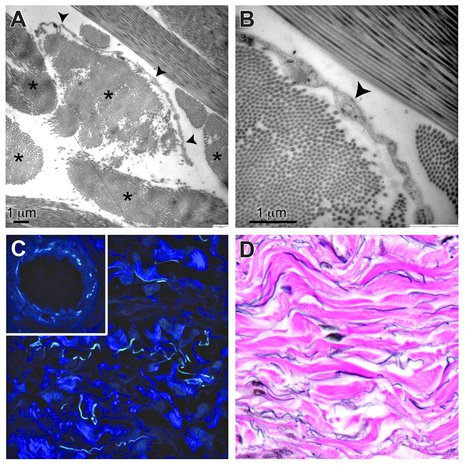 Uudella kuvaustekniikalla solujen välinen interstitium eli välikudos näyttäytyi erilaisena kuin ennen. Kuva: <span class="photographer">Scientific Reports, Neil Theise, David Carr-Locke</span>