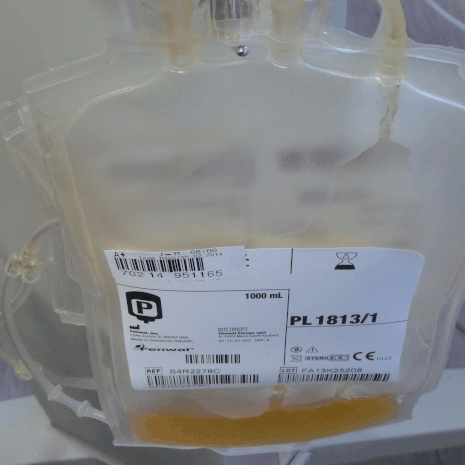 Plasma erotellaan kokoverestä koneellisesti. Kuva: <span class="photographer">Ankawu/Wikimedia Commons</span>