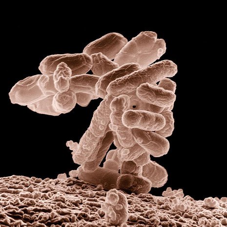 Tavallinen E.Coli -bakteeri syö sokeria. Kuva: <span class="photographer">Wikipedia</span>