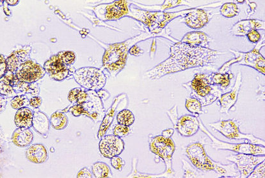 Kuva: <span class="photographer">CDC.</span>
