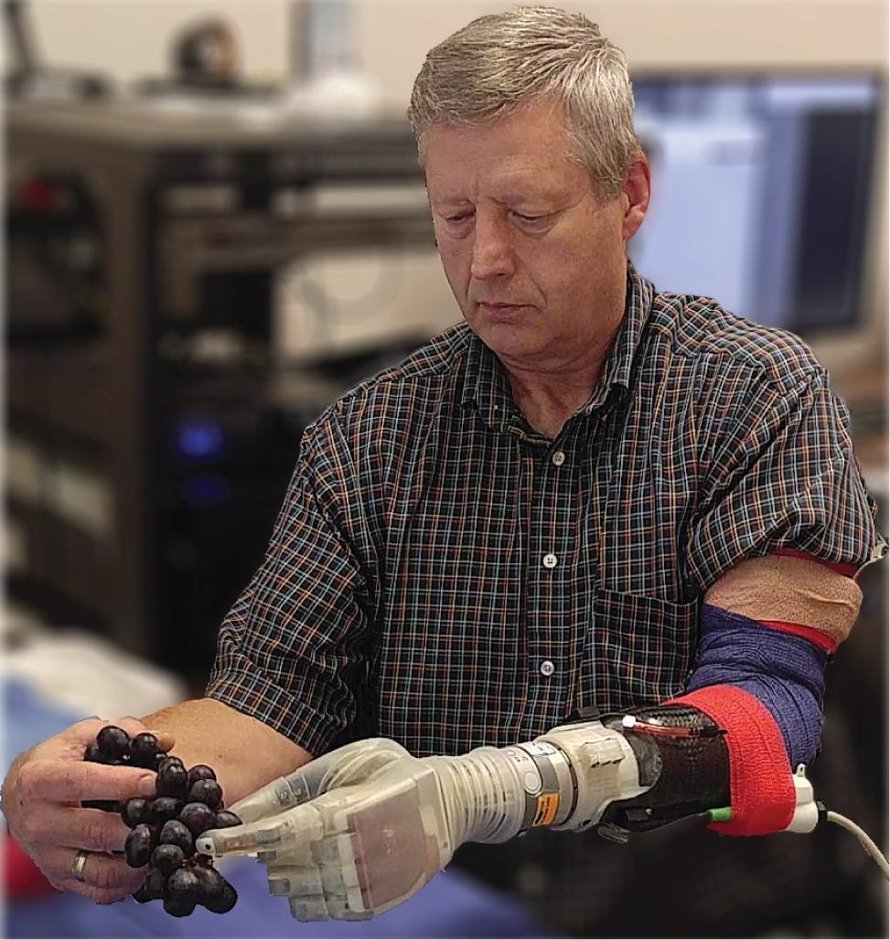 Keven Walgamott voi poimia siististi rypäleen kerrallaan. Kuva: <span class="photographer">University of Utah Center for Neural Interfaces</span>