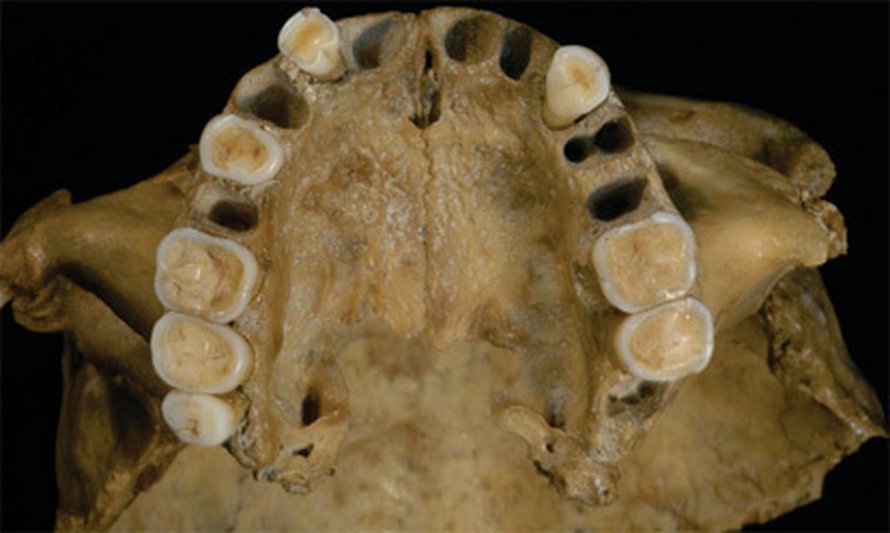 Romaniasta löytyneessä 30 000 vuotta vanhassa leuassa on sekä nykyihmisen että neandertalilaisen piirteita. Kuva: <span class="photographer">National Academy of Sciences</span>