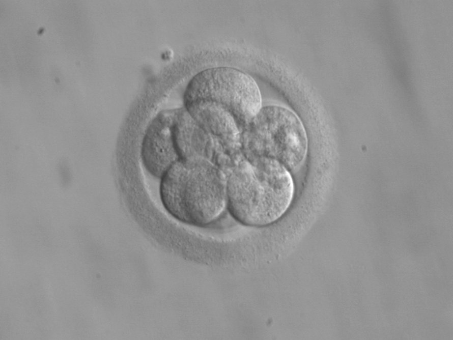 Ihmisen alkio 8-soluvaiheessa. Kuva: <span class="photographer">eker / Wikimedia Commons</span>