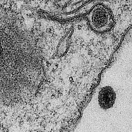 Yaravirukset tunkeutuvat kuvassa ameebaan. Ne erottuvat tummina täplinä. Kuva: <span class="photographer">J. ABRAHÃO AND B. LA SCOLA/IHU-MARSEILLE/MICROSCOPY CENTER UFMG-BELO HORIZONTE</span>