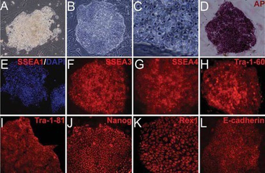 Vertailusoluja (A) ja erilaisilla merkkimolekyyleillä leimattuja sian iPS-soluja (B-L). Kuva: <span class="photographer">Journal of Molecular Cell Biology</span>