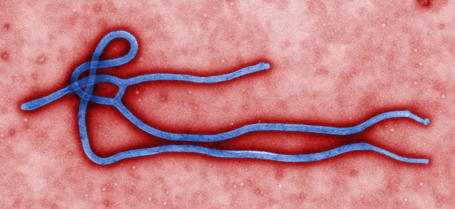 Kuvassa on Ebola-virioni, eli yksi viruspartikkeli. Kuva: <span class="photographer">Cynthia Goldsmith / CDC</span>