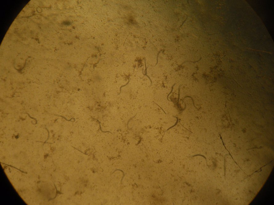 Ulostenäytteestä löytyy sukkulamato jos toinen. Kuva: <span class="photographer">Tuomas Aivelo</span>