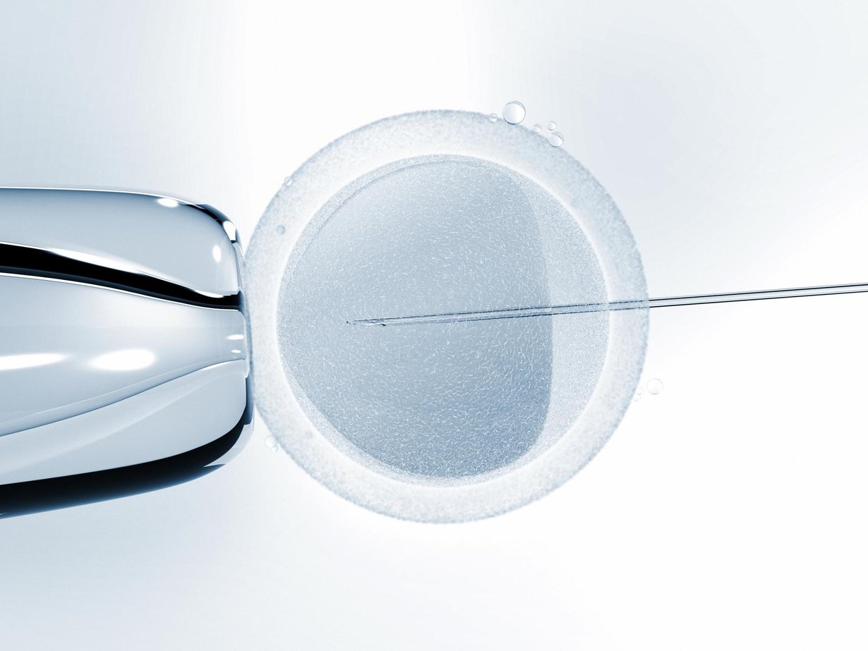 Mikroskoopikuvassa näkyy keinohedelmöitys. Genomic Prediction -yrityksen geenitesti otettaisiin keinohedelmöitetystä alkiosta. Kuva: Shutterstock