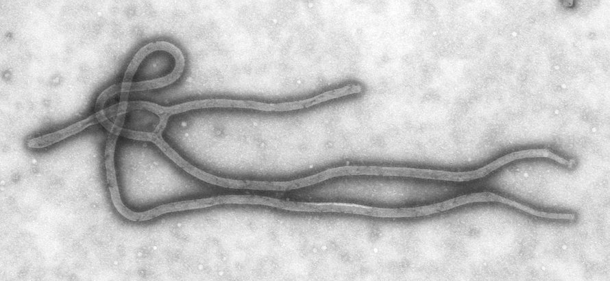Ebola-virus, yksi viidestä ebolaviruslajista, on päässyt kuvaan. Kuva: <span class="photographer">CDC</span>