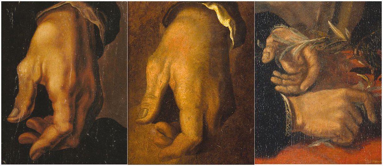 Nivelrikko näkyy Michelangelon käsissä, muun muassa peukalon tyven turvotuksessa. Kuva: The Metropolitan Museum of Art/Art Resource/Scala, Firenze